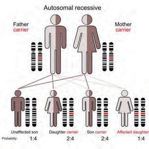 Autosomal recessive inheritance pedigree