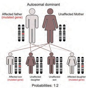 Autosomal dominant inheritance pedigree
