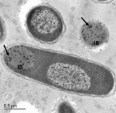 Electron micrograph of inclusion bodies