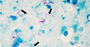 Acid-fast staining