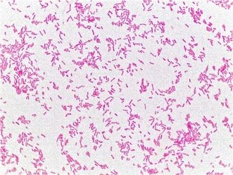 Bacillus arrangement