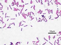 Bacillus arrangement with scale