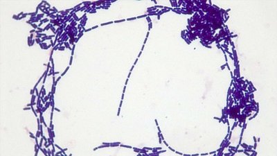 Streptobacillus arrangement