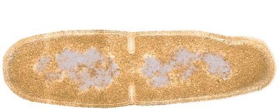 Prokaryotic chromosomes