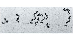Electron micrograph of polyribosomes