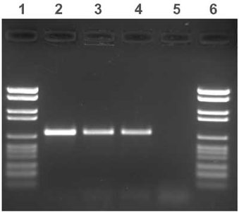 Gel image showing DNA fragments after restriction digestion