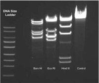 Gel electrophoresis result showing DNA bands and ladder