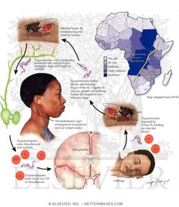 Life cycle and symptoms of African sleeping sickness