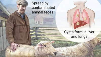 Echinococcosis transmission and cyst formation