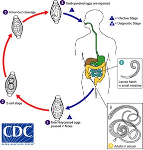 Life cycle of Trichuris trichiura (whipworm)