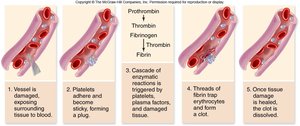 Blood clotting process: vessel damage, platelet plug, fibrin formation, clot dissolution