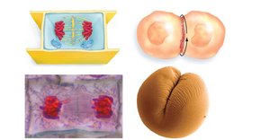 Comparison of cytokinesis in plant and animal cells
