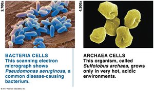 Electron micrograph of bacteria and archaea cells