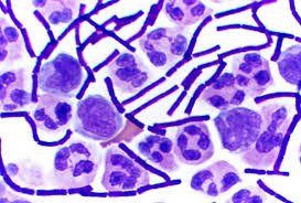 Gram-positive bacteria under microscope