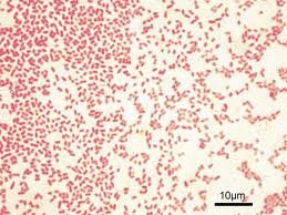 Gram-negative bacteria under microscope