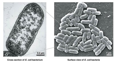 Electron microscopy: E. coli cross section and surface view