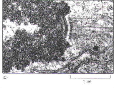 Electron micrograph of a kinetochore on a chromosome