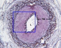 Histological section of a blood vessel