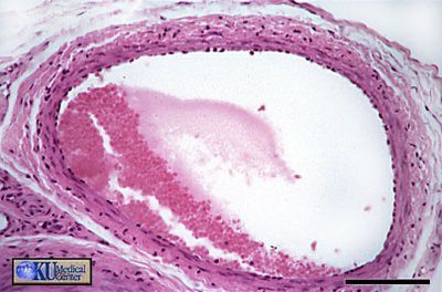 Histological section of a blood vessel