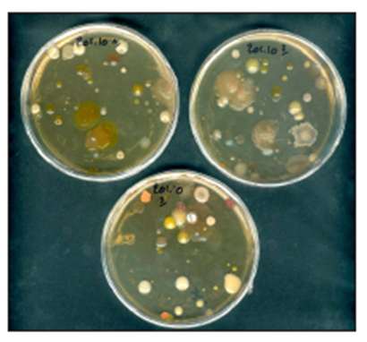 Petri dishes with microbial colonies