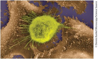 Cancer cell with normal neighbors