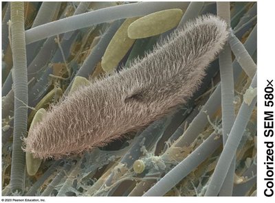 Colorized SEM image of a cell