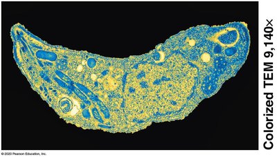 Colorized TEM image of a cell