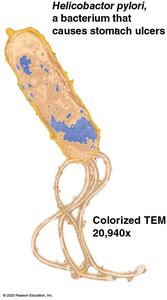 Helicobacter pylori TEM