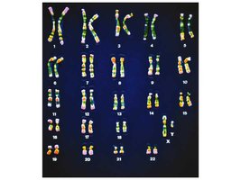 Human karyotype showing pairs of chromosomes