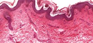 Histological section of tissue