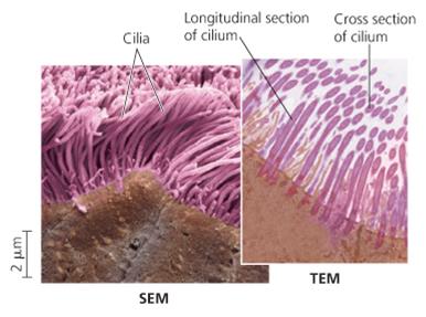 SEM and TEM images of cilia