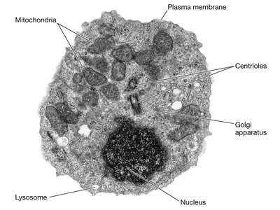 TEM of cell with labeled lysosome