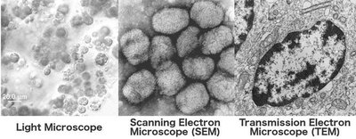 Comparison of light, SEM, and TEM microscopy