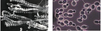 Aspergillus and Saccharomyces cerevisiae under microscope