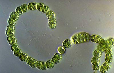 Microscopic image of Nostoc