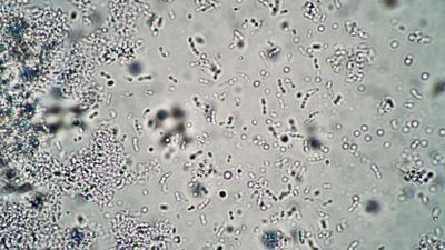 Wet mount of yogurt showing bacteria