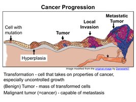 Cancer progression from mutation to metastasis