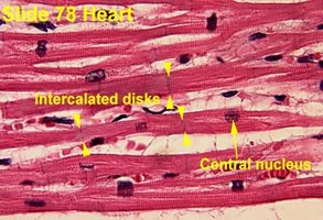 Histology of cardiac muscle showing intercalated discs