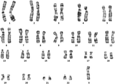 Human karyotype