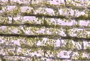 Plasmolysis in plant cells (hypertonic)