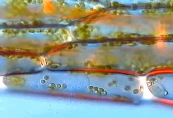 Turgid plant cells (hypotonic)