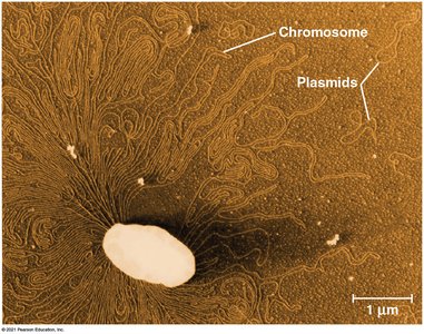 Electron micrograph of a prokaryote with chromosome and plasmids