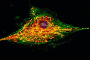 Fluorescent micrograph of cell cytoskeleton and cytoplasm
