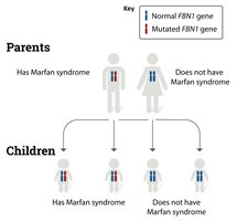 Marfan syndrome inheritance