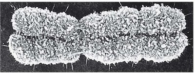 Electron micrograph of a duplicated chromosome
