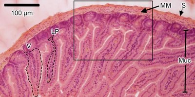 Light micrograph of stained tissue