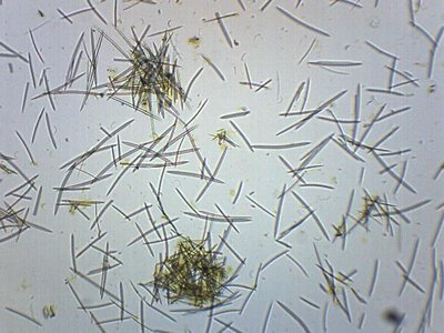 Types of spicules