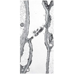 TEM image of sieve-tube elements and sieve plates