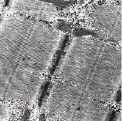 Glycogen granules in muscle tissue