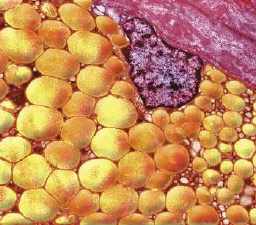 Adipose cell with fat droplets